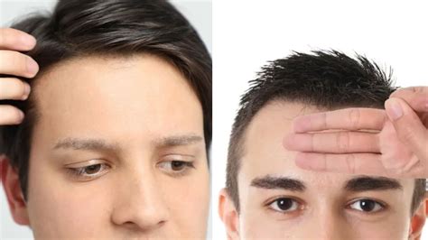 Consider the width of your forehead: