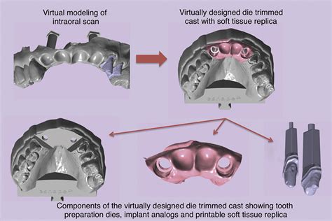 Contemporary Fixed Prosthodontics Epub