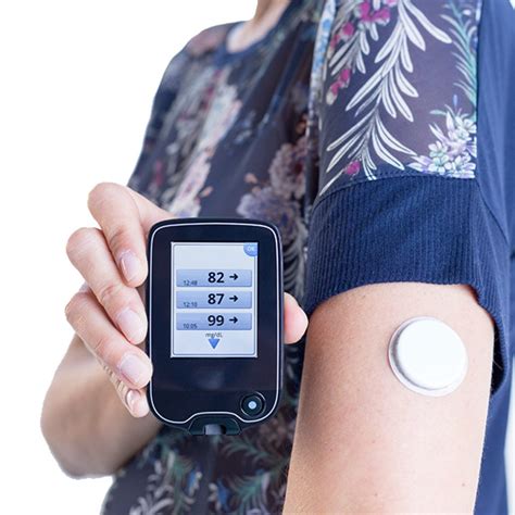 Continuous glucose monitoring (CGM)