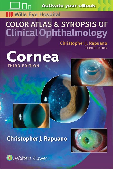 Cornea Color Atlas and Synopsis of Clinical Ophthalmology Doc