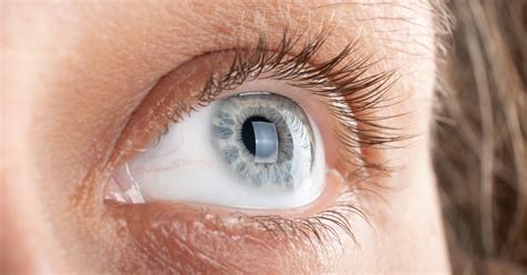 Corneal Ulcer Healing Time: A Comprehensive Guide to Recovery