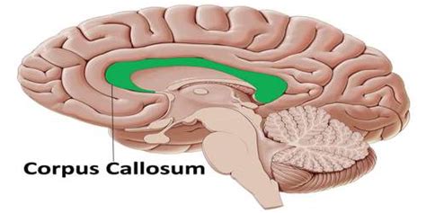 Corpus Callosum: AP Psychology Definition and Functions