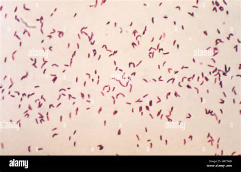 Corynebacterium diphtheriae