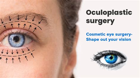 Cosmetic Oculoplastic Surgery Eyelid Doc