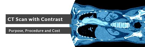 Cost of CT Scan with Contrast: A Comprehensive Guide