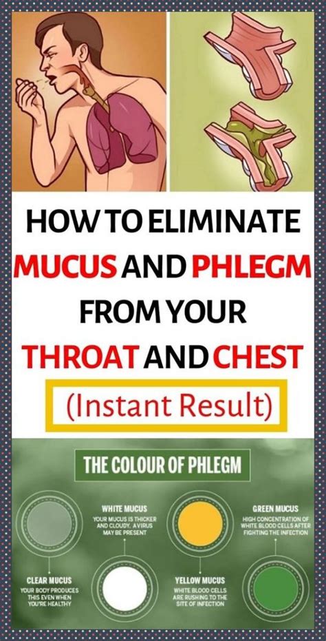 Coughing Up Green Phlegm: What It Means and 4 Natural Remedies