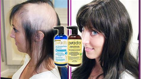 Courtney Topper: The Ultimate Hair Loss Solution