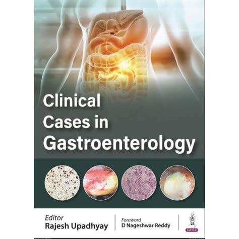 Critical Issues in Gastroenterology 1st Edition Epub