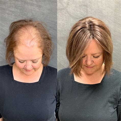 Crown Toppers: A Revolutionary Hair Solution for Thinning Crown Areas