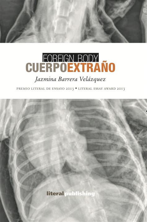 Cuerpo extrano Foreign Body Spanish Edition Doc