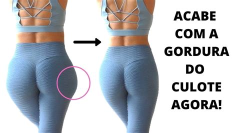 Culote: O Que É, Como Evitar e Tratar