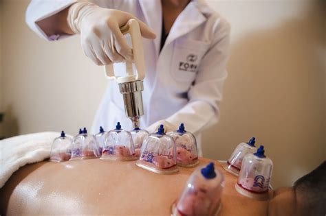 Cupping Therapy: A Comprehensive Guide to Finding Cupping Therapy Near You