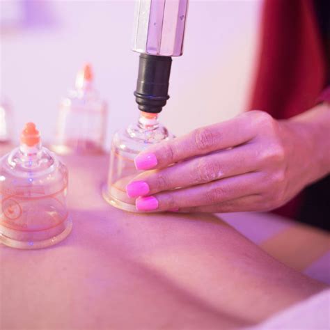 Cupping Therapy Singapore: 7 Reasons Why It's a Must-Try