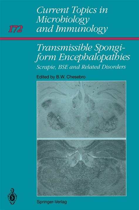 Current Topics in Microbiology and Immunology Tansmissible Soingiform Encephalopathies Scrapie Epub