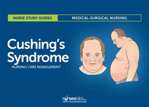 Cushing Syndrome 1st Edition PDF