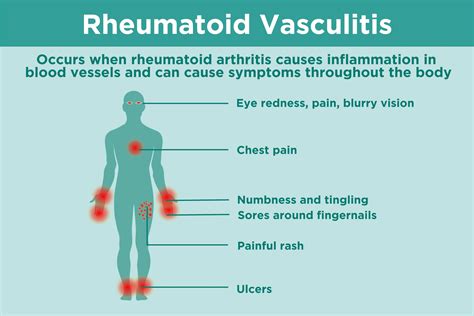 Cutaneous Manifestations of Rheumatic Diseases Epub