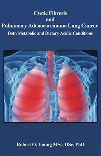 Cystic Fibrosis and Pulmonary Adenocarcinoma Both Metabolic and Dietary Acidic Conditions PDF