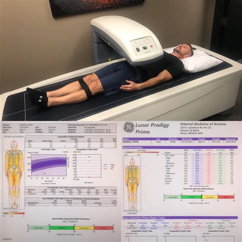 DEXA Scan: The Gold Standard for Body Composition Analysis