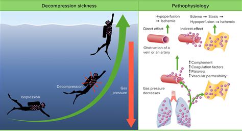 Decompression sickness: