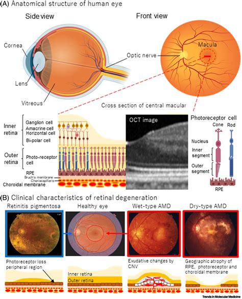 Degenerative Retinal Diseases PDF