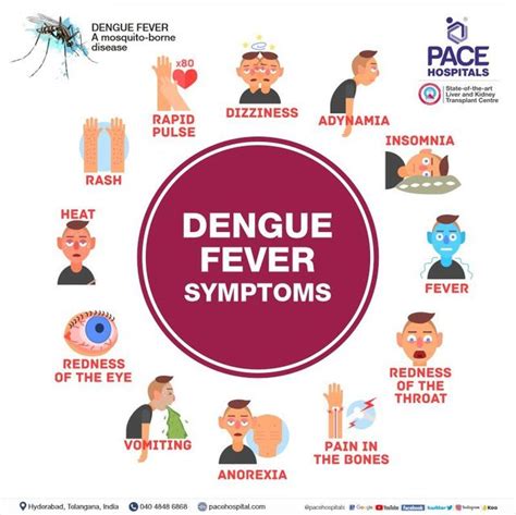 Dengue fever: