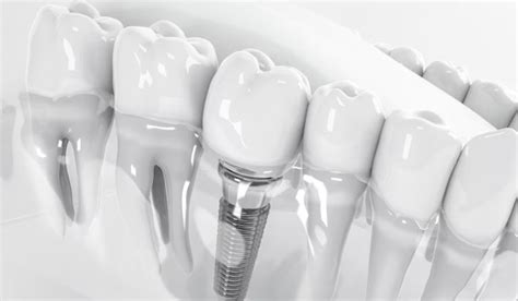 Denitol: The Revolutionary Oral Care Solution Transforming Smiles!