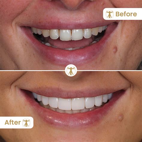 Dental Dreams: Transforming Smiles in Chicago Heights