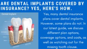 Dental Implants Covered by Insurance: The Ultimate Guide