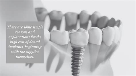 Dental Implants Insurance: Uncovering the 4 Critical Truths