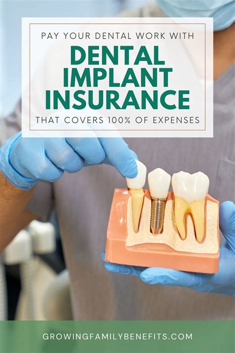 Dental Insurance That Covers Implants Immediately: Your Complete Guide