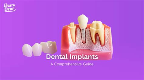 Dental Insurance That Includes Implants: A Comprehensive Guide