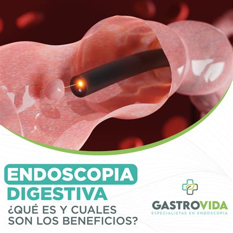 Descubra os Benefícios Poderosos da Endogastro Endoscopia Digestiva