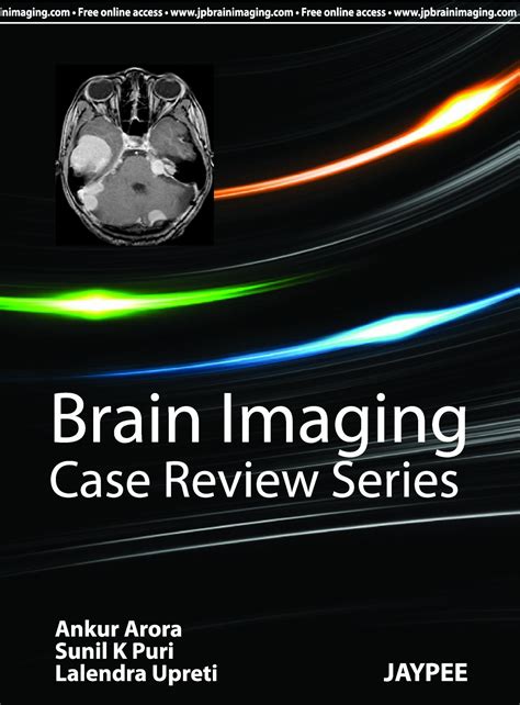 Deta Brain Series Answers Ebook Ebook Doc