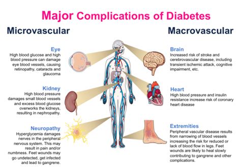 Diabetes: Chronic Complications (Practical Diabetes) PDF