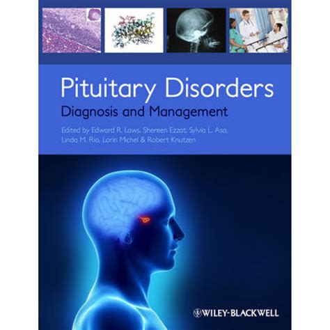 Diagnosis and Management of Pituitary Disorders Epub