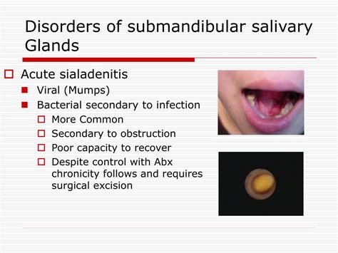 Diagnosis of Salivary Gland Disorders PDF