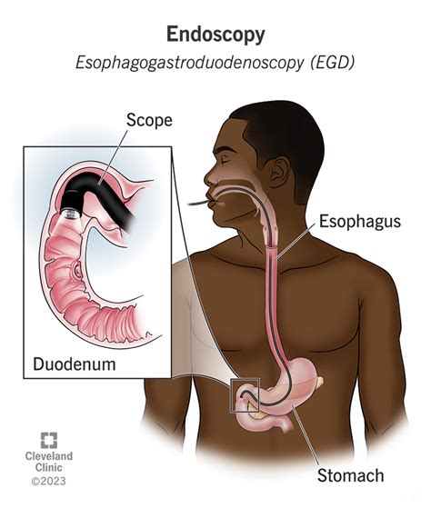 Diagnostic Endoscopy: