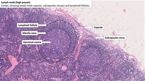 Diagnostic Histopathology of the Lymph Node PDF