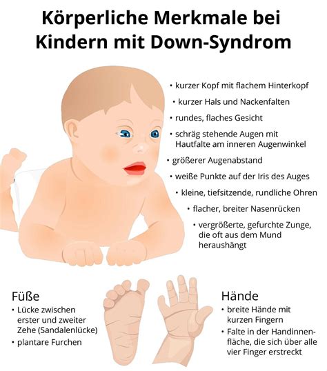 Die ultimative Anleitung zum Florian-Hipp-Syndrom: Symptome, Ursachen und Behandlung