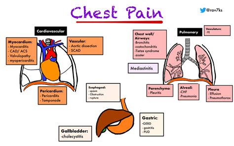 Differential Diagnosis of Diseases of the Chest Kindle Editon