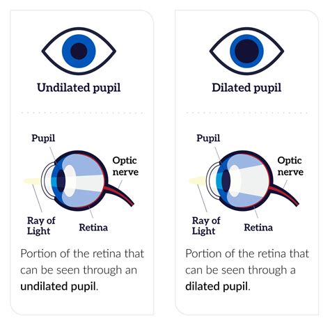 Dilates the pupils