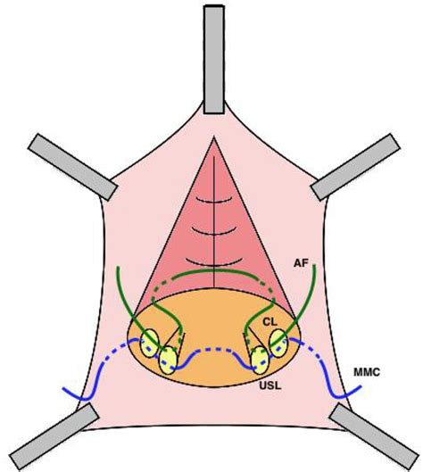 Discover the Cutting-Edge Advancements in McCall Culdoplasty