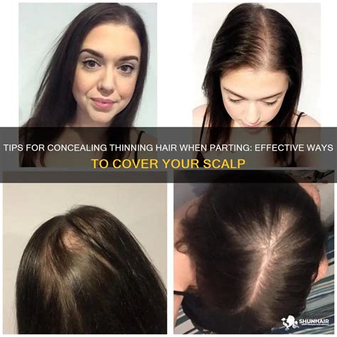 Discover the Secret to Concealing Thinning Hair with Innovative Hair Covers