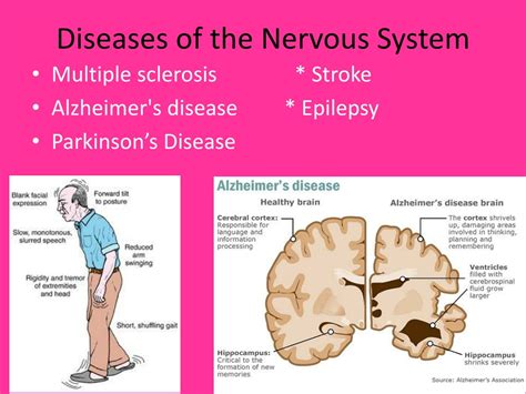 Disease of Nervous System & Psychiatry [Ayurvedic &a Epub