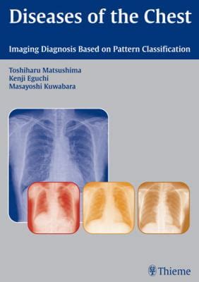 Diseases of the Chest Imaging Diagnosis Based on Pattern Classification Kindle Editon