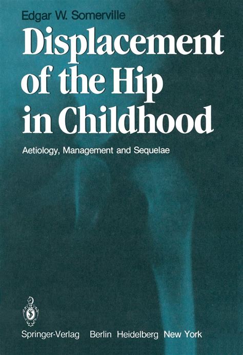 Displacement of the Hip in Childhood Aetiology, Management and Sequelae Reader