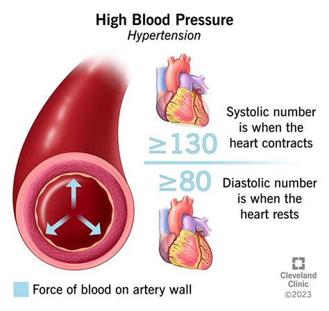 Does Zyn Cause High Blood Pressure? Uncover the Truth