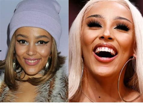 Doja Cat: Before and After 10,000