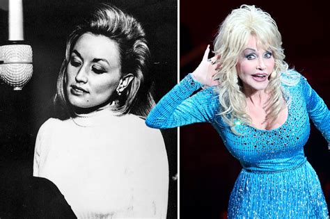 Dolly Parton's real hair