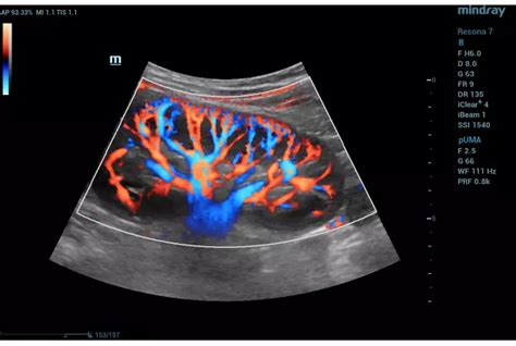 Doppler Color Imaging PDF